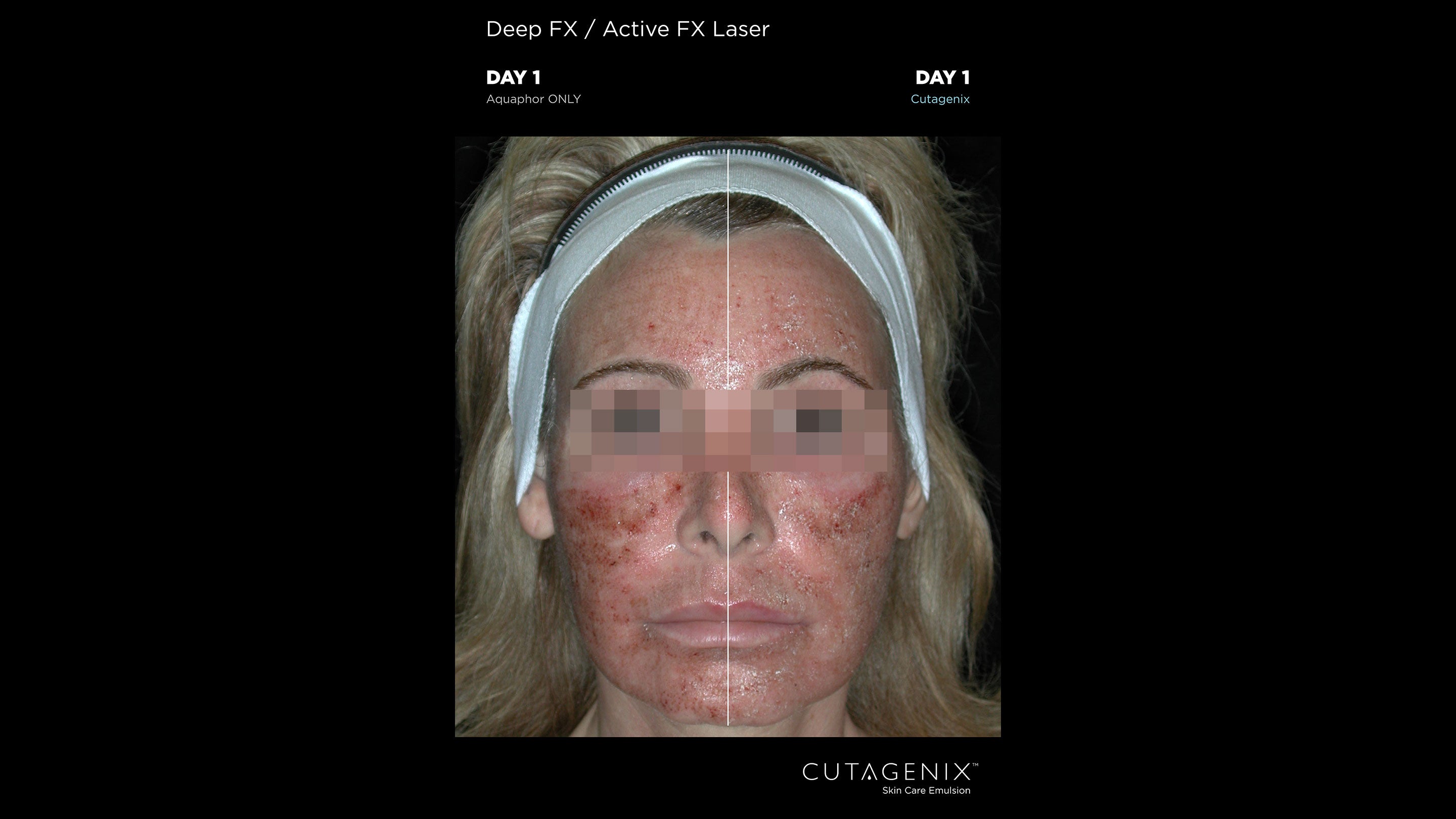 CUTAGENIX™ BEFORE AFTER WOMAN | Cutagenesis™ - Where Professional Skin Care Begins